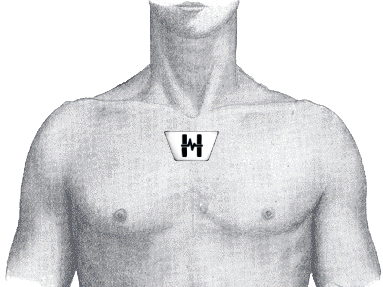 feature-image